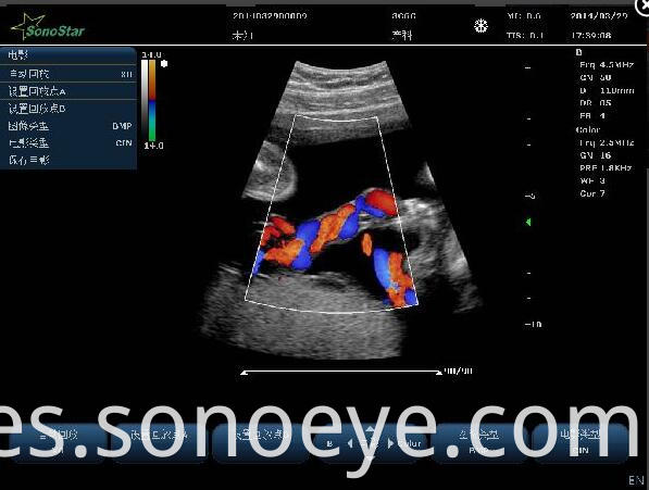 C10 Color Doppler Ultrasound System For Hostipal